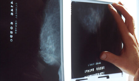 © National Cancer Institute / Unsplash